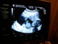 /album/mundo-ecografico/a2012-01-18-14-39-20-jpg/